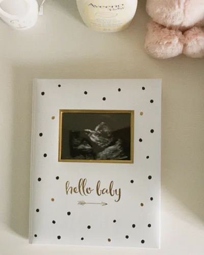 „Hello baby” babanapló – az első év emlékkönyve