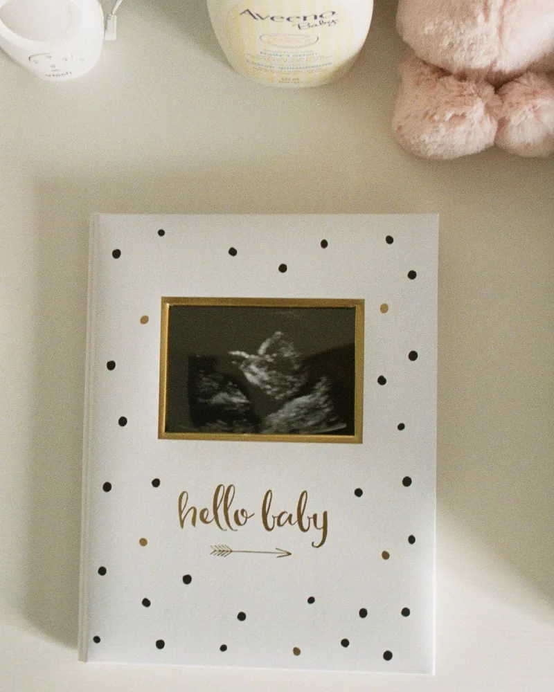 „Hello baby” babanapló – az első év emlékkönyve
